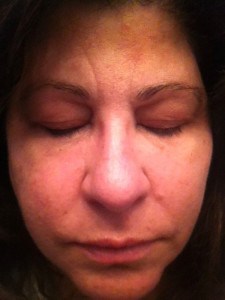 frownies wrinkles forehead patches rid bingo try need stomach