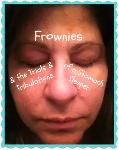 How to Get Rid of Forehead Wrinkles with Frownies Patches