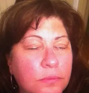 Frownies has an entire line of facial antiaging products